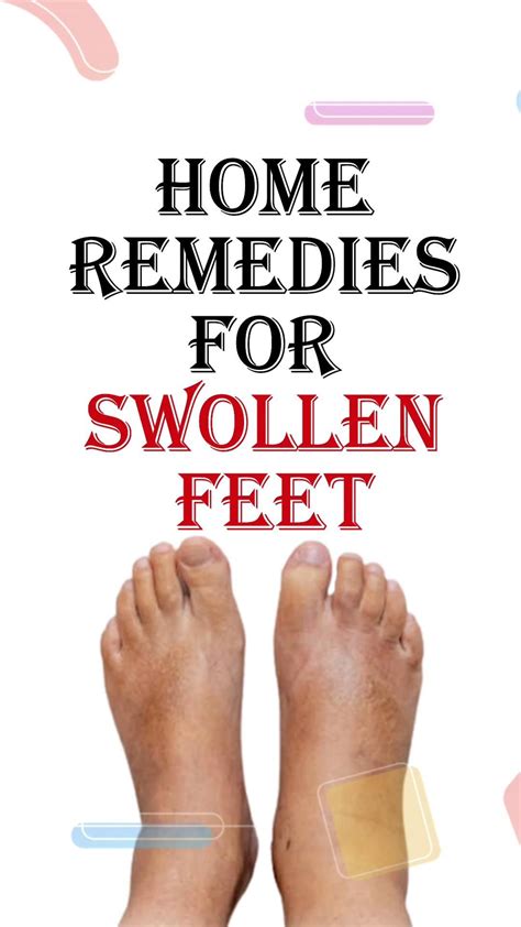 Effective Home Remedies For Swollen Feet Artofit