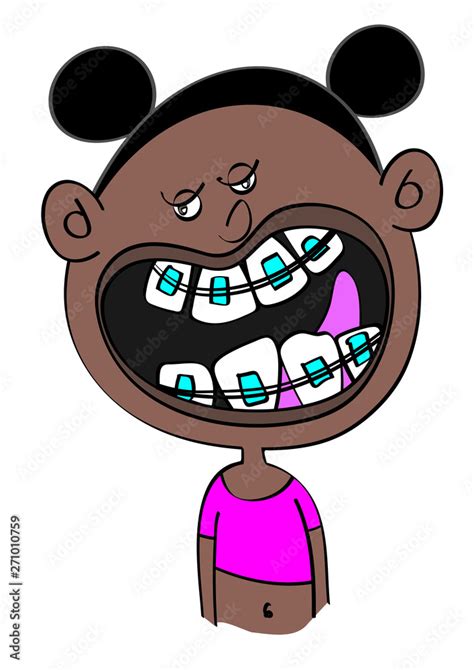 Funny Black Girl With Dental Braces Cartoon Vector Illustration Stock