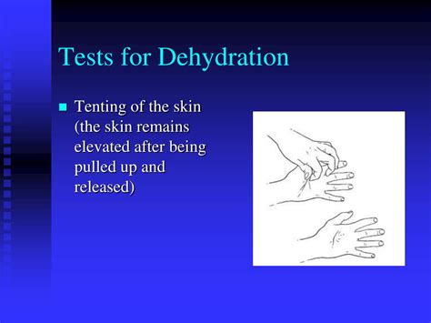 Ppt Dehydration In Boxing Powerpoint Presentation Free Download Id
