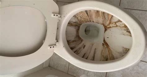 Black Sediments In Toilet Bowl Remove Black Stuff Spots Stains