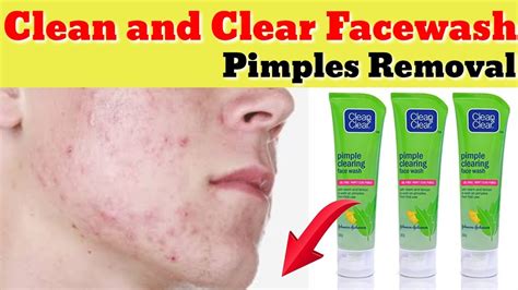 Clean And Clear Pimples Facewash Review Face Beauty Tips Youtube