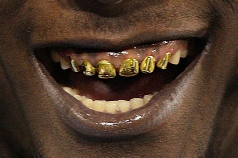 The site owner hides the web page description. Gold grills are the trendy accessory among all the young age people. | Top Grillz - Yellow Gold ...