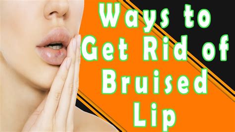 How To Heal A Bruised Lip From Kissing Update New Abettes