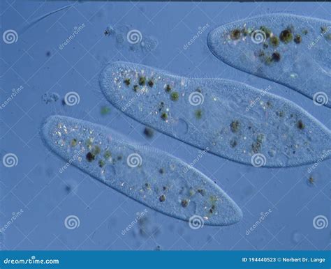 Paramecium With Vacuoles Under The Microscope Stock Image Image Of