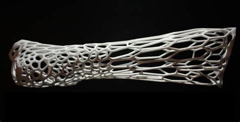 Worlds Most Amazing Sights Cortex A Conceptual 3d Printed Exoskeletal Cast By Jake Evill