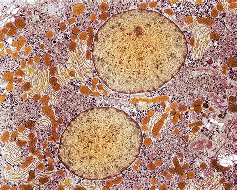 Liver Cell Tem Stock Image P5300187 Science Photo
