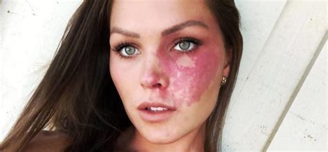 Stain definition, a discoloration produced by foreign matter having penetrated into or chemically reacted with a material; Birthmark Location Meanings - Self-Knowledge Through ...