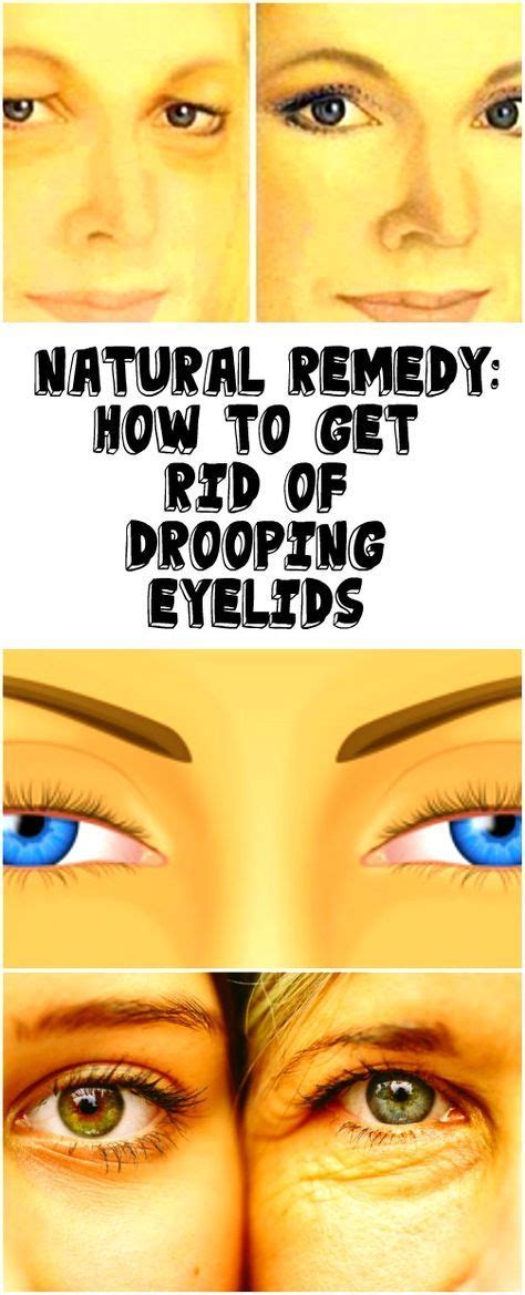 Natural Remedy How To Get Rid Of Drooping Eyelids Drooping Eyelids
