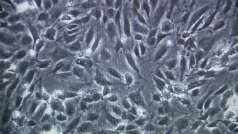 It causes a disease similar to that caused by the marburg virus. Ebola Virus Moving Under Microscope. Stock Footage Video ...