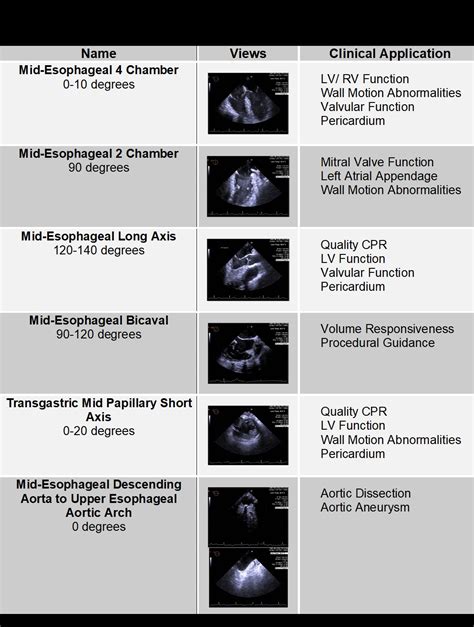 Em Ultrasound Critical Care Updates Two Views To Save Lives