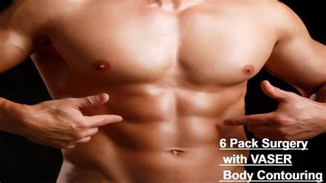 6 Pack Surgery With Vaser 4d Body Contouring Youtube