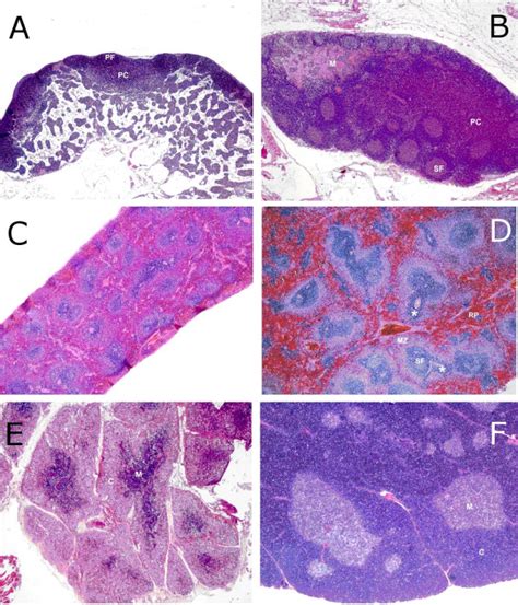 Histopathology Of Rat Lymphoid Organs On Day 8 Pi 16 000 Ml Left