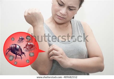 Female Rash Allergic Dust Mites Dust Stock Photo 489682552 Shutterstock