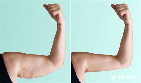 7 Exercises For Flabby Arms Over 60 Welltech