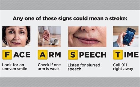 What Signs To Look For In Stroke Blog Loyola Medicine