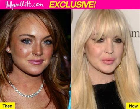 Lindsay Lohan Plastic Surgery A Minimal Lip Job Done Well