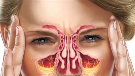 Nasal Sinuses Anatomy Faculty Of Medicine