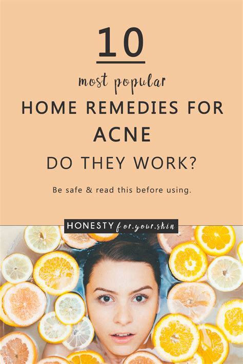 10 most popular home remedies for acne do they work honesty for your skin