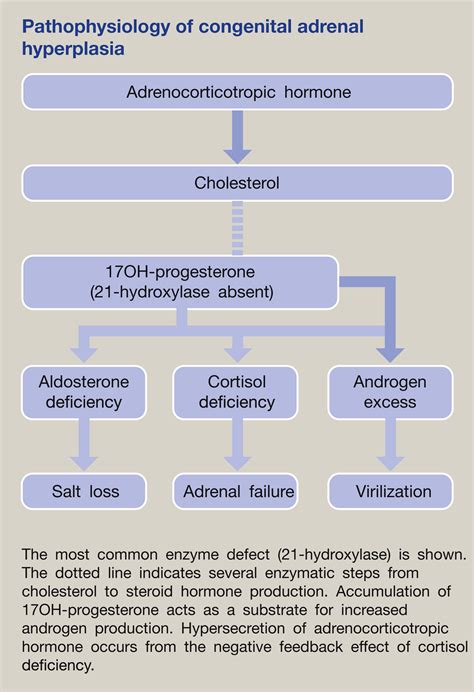 Congenital Adrenal Hyperplasia Medicine
