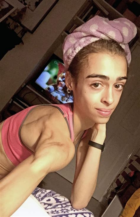 Latest Updates Shocking Transformation Of Anorexic Ballet Dancer After