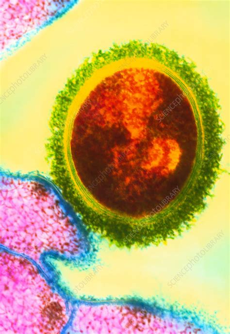 Coloured Tem Of Streptococcus Bacterium Stock Image B2360109