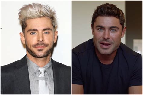 New Clip Of Zac Efron Sparks Plastic Surgery Rumors