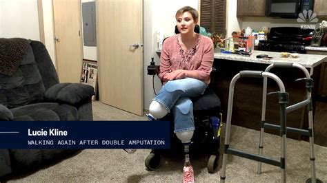 Kansas Woman Thriving After Losing Legs In Surgery Complications