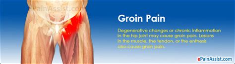 Pain In Hip Groin And Inner Thigh Fat