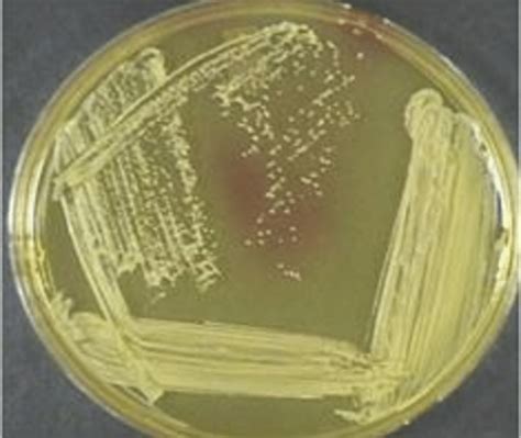 Staphylococcus Aureus On Manitol Salt Agar Download Scientific Diagram