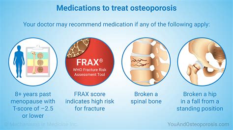 Slide Show Managing And Treating Osteoporosis