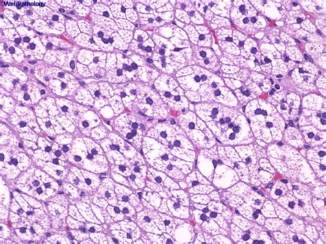 Medical School • Adrenal Histology The Zona fasciculata lies...