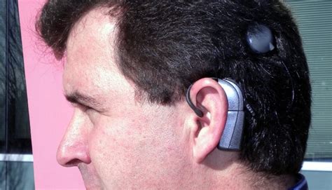 Artificial Cochlea Gives Hearing To The Deaf Reduce Healthcare Costs