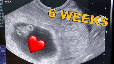 6 Weeks 5 Days Pregnancy Ultrasound ️ Heartbeat Youtube