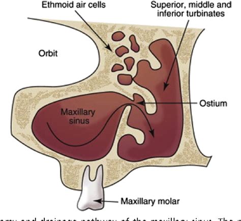 Maxillary Sinus Augmentation Semantic Scholar