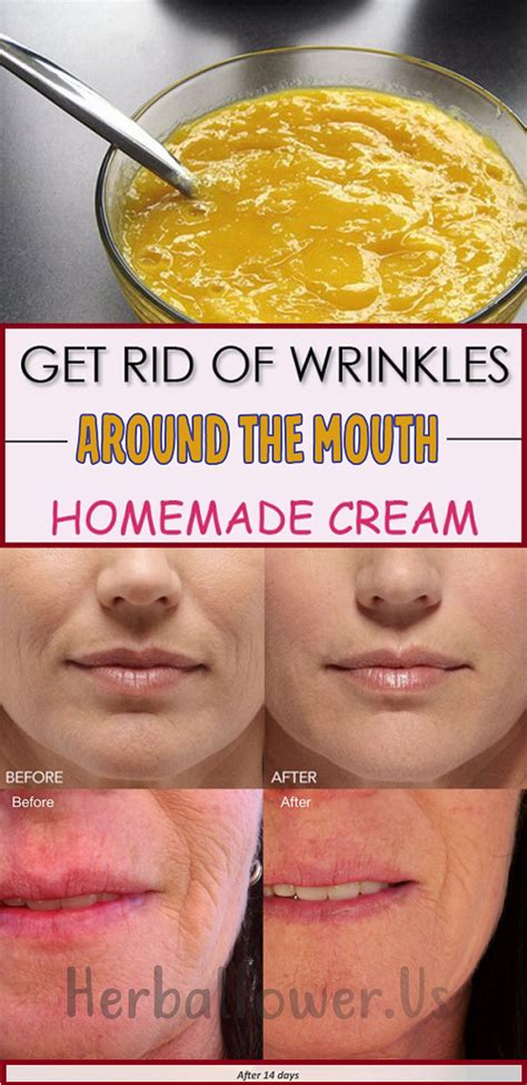 Get Rid Of Wrinkles Around The Mouth Homemade Cream Homemade Wrinkle