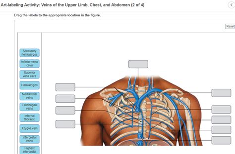 Solved Art Labeling Activity Arteries Of The Chest And