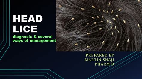 Head Lice Diagnosis And Management Medical Information Ppt