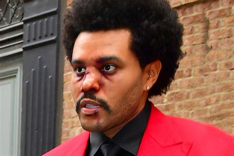 Abel makkonen tesfaye (born february 16, 1990), known professionally as the weeknd, is a canadian singer, songwriter, and record producer. The Weeknd looks rough for his VMAs performance and more ...