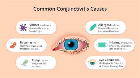 Conjunctivitis A K A Pink Eyes A Beginners Guide