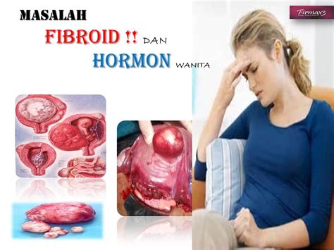 Semua ubat hormon ditetapkan untuk masa yang lama. FIRMAX3 beauty: Masalah Fibroid Dan Hormon Wanita