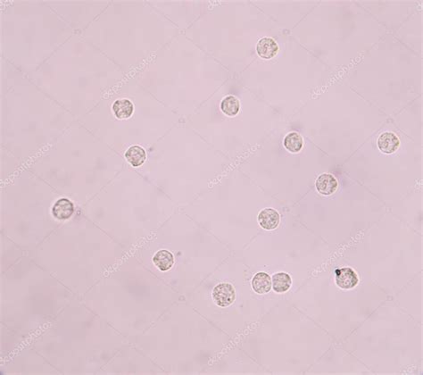 White Blood Cells In Urine — Stock Photo © Toeytoey 126131124