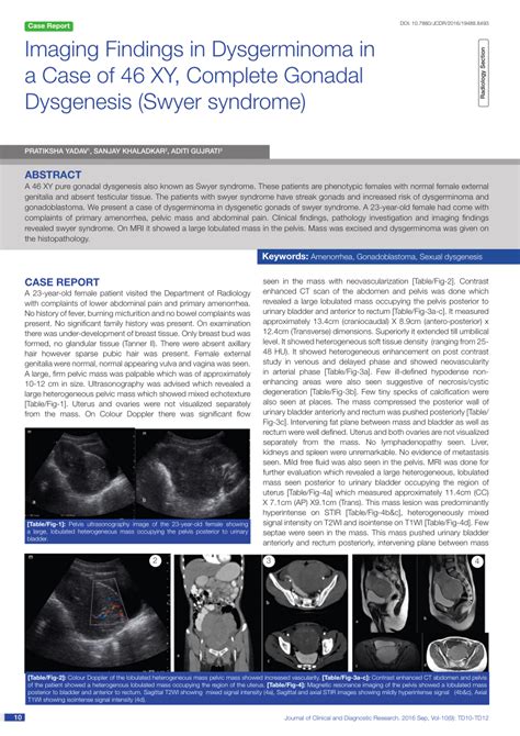 pdf imaging findings in dysgerminoma in a case of 46 xy complete gonadal dysgenesis swyer