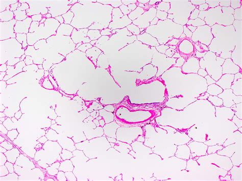 Alveolar Epithelium Histology