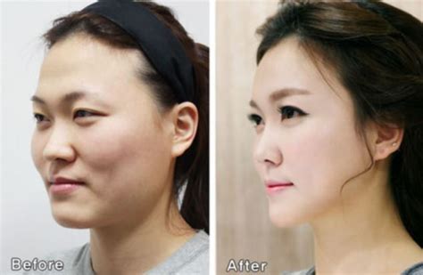 South Korean Plastic Surgery So Good People Need Certificates To Prove