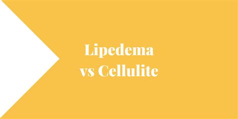 Lipedema Vs Cellulite Lipedema And Me
