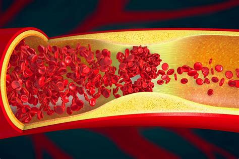 Blood Clot Signs You Should Never Ignore Before