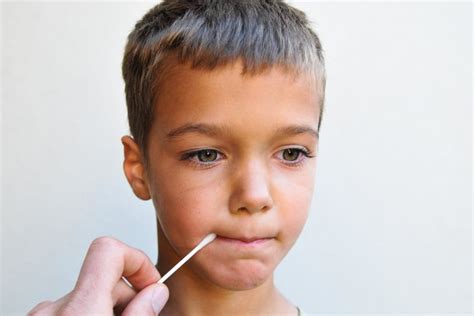Canker Sore Remedies For Kids
