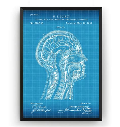 Anatomical Head 1884 Patent Print Anatomy Medical Wall Art Etsy Uk