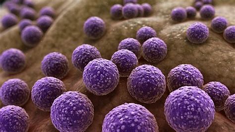 Mrsa Methicillin Resistant Staphylococcus Aureus Di Indonesia Permasalahan Dan Solusi Unair