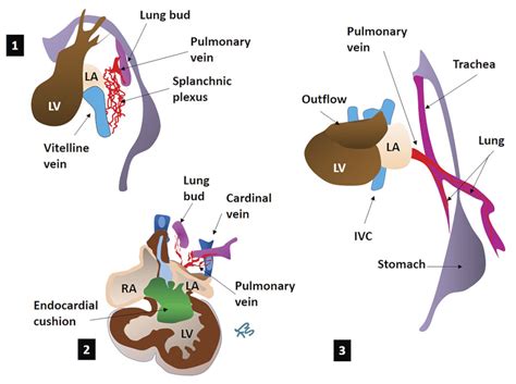 7 Pulmonary And Systemic Veins Radiology Key